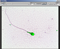 MMC Sperm Morphology Detection