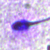 MMC Sperm DNA Fragmentation Degraded