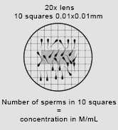 MMC-SPM counting chmaber, sperm concentration assessment
