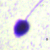 MMC Sperm DNA Fragmentation Without Halo